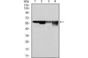 Western blot analysis using G6PD mouse mAb against Hela (1), MCF-7 (2), Jurkat (3) and K562 (4) cell lysate. (Glucose-6-Phosphate Dehydrogenase 抗体)