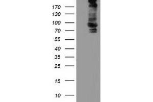 Western Blotting (WB) image for anti-Aldehyde Dehydrogenase 1 Family, Member L1 (ALDH1L1) antibody (ABIN1496583) (ALDH1L1 抗体)