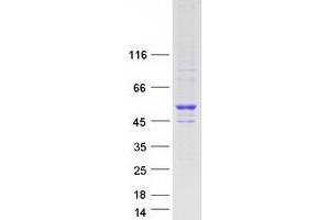 Validation with Western Blot