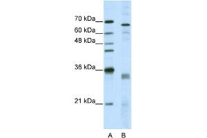 WB Suggested Anti-SFRS1 Antibody Titration:  5.