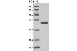 (Tris-Glycine gel) Discontinuous SDS-PAGE (reduced) with 5 % enrichment gel and 15 % separation gel.