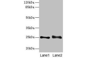 Western blot All lanes: RAB3B antibody at 4 μg/mL Lane 1: Mouse brain tissue Lane 2: U87 whole cell lysate Secondary Goat polyclonal to rabbit IgG at 1/10000 dilution Predicted band size: 25 kDa Observed band size: 25 kDa (RAB3B 抗体  (AA 1-219))