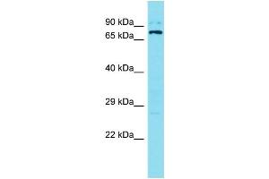 Western Blotting (WB) image for anti-Sosondowah Ankyrin Repeat Domain Family Member B (SOWAHB) (C-Term) antibody (ABIN2791404) (SOWAHB 抗体  (C-Term))