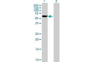Western Blot analysis of ALAD expression in transfected 293T cell line by ALAD MaxPab polyclonal antibody.