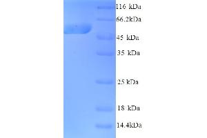 SDS-PAGE (SDS) image for Kynurenine 3-Monooxygenase (Kynurenine 3-Hydroxylase) (KMO) (AA 1-486), (full length) protein (His tag) (ABIN4975815) (KMO Protein (AA 1-486, full length) (His tag))