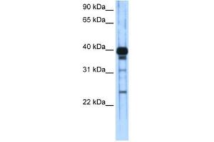 WB Suggested Anti-ZSCAN16 Antibody Titration:  0. (ZSCAN16 抗体  (C-Term))