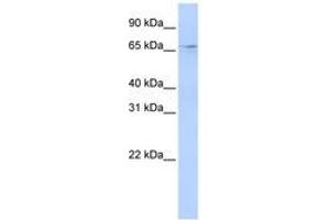 Image no. 1 for anti-APOBEC1 Complementation Factor (A1CF) (N-Term) antibody (ABIN6740710) (A1CF 抗体  (N-Term))