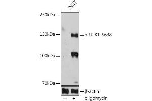 Western blot analysis of extracts of 293T cells, using Phospho-ULK1-S638 antibody (ABIN7271219) at 1:1000 dilution. (ULK1 抗体  (pSer638))