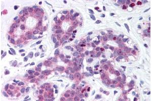 Human Breast (formalin-fixed, paraffin-embedded) stained with ESR1 antibody ABIN214159 at 1:800 followed by biotinylated anti-mouse IgG secondary antibody ABIN481714, alkaline phosphatase-streptavidin and chromogen. (ITIH1 抗体  (AA 410-592))