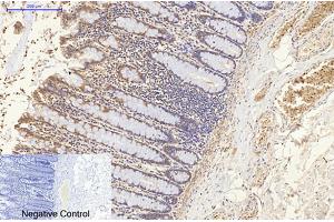 Immunohistochemical analysis of paraffin-embedded human colon tissue. (ENO2/NSE 抗体)