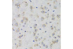 Immunohistochemistry of paraffin-embedded rat brain using ISG15 Antibody (ABIN5970528) at dilution of 1/100 (40x lens). (ISG15 抗体)