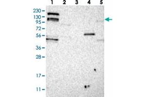 Western blot analysis of Lane 1: RT-4, Lane 2: U-251 MG, Lane 3: Human Plasma, Lane 4: Liver, Lane 5: Tonsil with ARHGEF10L polyclonal antibody . (ARHGEF10L 抗体)