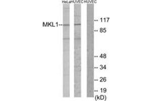 Western Blotting (WB) image for anti-Megakaryoblastic Leukemia (Translocation) 1 (MKL1) (AA 10-59) antibody (ABIN2889716) (MKL1 抗体  (AA 10-59))