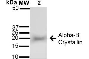 Western blot analysis of Rat Brain cell lysates showing detection of ~22 kDa Alpha B Crystallin protein using Rabbit Anti-Alpha B Crystallin Polyclonal Antibody (ABIN361836 and ABIN361837). (CRYAB 抗体)