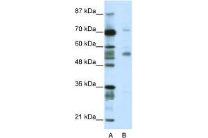 WB Suggested Anti-CORO1A Antibody Titration:  2. (Coronin 1a 抗体  (N-Term))