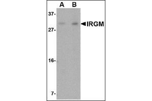 Western blot analysis of IRGM in Rat brain lysate with this product at (A) 1 and (B) 2 μg/ml. (IRGM 抗体  (N-Term))