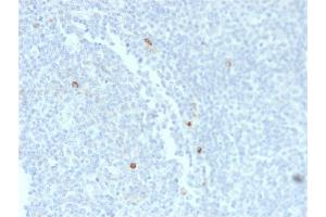 Formalin-fixed, paraffin-embedded human Tonsil stained with IgM Mouse Recombinant Monoclonal Antibody (rIM373). (Recombinant IGHM 抗体)