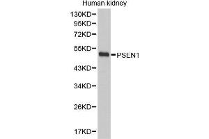 Western Blotting (WB) image for anti-Presenilin 1 (PSEN1) (AA 1-160) antibody (ABIN3023160) (Presenilin 1 抗体  (AA 1-160))