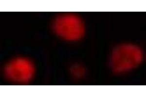 ABIN6274319 staining HeLa cells by IF/ICC. (SRY 抗体  (Internal Region))