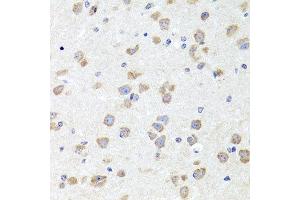 Immunohistochemistry of paraffin-embedded mouse brain using CHD1 antibody at dilution of 1:100 (x40 lens). (CHD1 抗体)