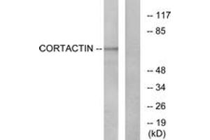 Western blot analysis of extracts from HeLa cells, treated with H2O2, using Cortactin (Ab-421) Antibody. (Cortactin 抗体  (AA 388-437))