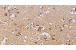 Immunohistochemistry of paraffin-embedded Human brain using FXYD1 Polyclonal Antibody at dilution of 1:60 (FXYD1 抗体)