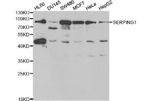 Western blot analysis of extracts of various cell lines, using SERPING1 antibody. (SERPING1 抗体  (AA 201-500))