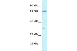 WB Suggested Anti-Lzts1 Antibody   Titration: 1. (LZTS1 抗体  (C-Term))