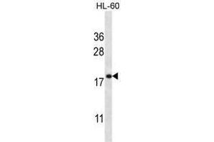 TMM70 Antibody (C-term) western blot analysis in HL-60 cell line lysates (35 µg/lane). (Transmembrane Protein 70 (TMM70) (AA 230-260), (C-Term) 抗体)