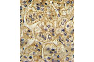 Immunohistochemistry (IHC) image for anti-Adaptor-Related Protein Complex 2, alpha 2 Subunit (AP2A2) antibody (ABIN3003799) (AP2A2 抗体)