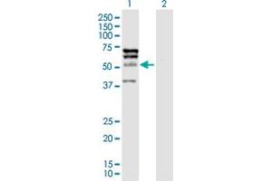 Western Blotting (WB) image for anti-ELK4, ETS-Domain Protein (SRF Accessory Protein 1) (ELK4) (AA 1-405) antibody (ABIN515261)