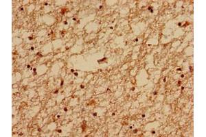Immunohistochemistry analysis of human brain tissue using ABIN7159132 at dilution of 1:100 (MED24 抗体  (AA 1-300))