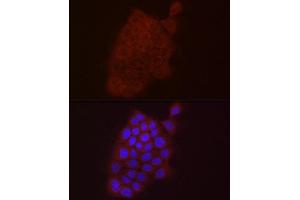 Immunofluorescence (IF) image for anti-S100 Calcium Binding Protein A10 (S100A10) (AA 1-97) antibody (ABIN7270123)