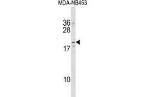 Western blot analysis in MDA-MB453 cell line lysates (35ug/lane) using NKAIN2  Antibody . (NKAIN2 抗体  (Middle Region))