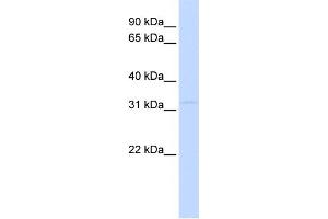 WB Suggested Anti-PITPNB Antibody Titration: 0. (PITPNB 抗体  (Middle Region))