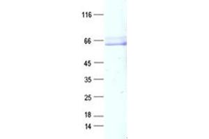 Western Blotting (WB) image for SH3-Domain Binding Protein 5 (SH3BP5) protein (DYKDDDDK Tag) (ABIN2731977)