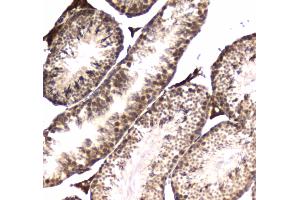 IHC analysis of POLR2A using anti-POLR2A antibody . (POLR2A/RPB1 抗体  (AA 1148-1384))