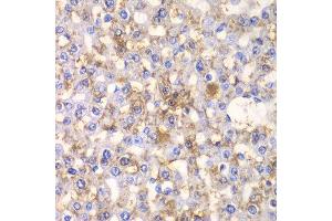 Immunohistochemistry of paraffin-embedded rat liver using HAPLN1 antibody at dilution of 1:100 (x40 lens).