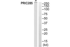 Western blot analysis of extracts from Jurkat cells, using PRIC285 antibody. (HELZ2 抗体  (Internal Region))