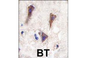 Formalin-fixed and paraffin-embedded human brain tissue reacted with CDH12 antibody , which was peroxidase-conjugated to the secondary antibody, followed by DAB staining. (Cadherin 12 抗体  (N-Term))