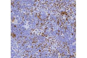 IHC analysis of Cdc25b using anti-Cdc25b antibody (ABIN7599793). (CDC25B 抗体  (AA 118-339))