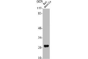 Western Blot analysis of RAT-MUSCLE cells using Six3/6 Polyclonal Antibody (SIX Homeobox 6 抗体  (Internal Region))