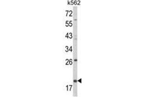 Western blot analysis of KLRD1 Antibody (N-term) in K562 cell line lysates (35ug/lane). (CD94 抗体  (N-Term))