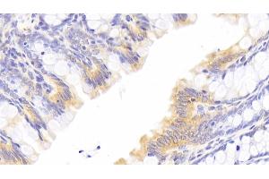 Detection of HMGCR in Rat Colon Tissue using Polyclonal Antibody to 3-Hydroxy-3-Methylglutaryl Coenzyme A Reductase (HMGCR) (HMGCR 抗体  (AA 638-887))