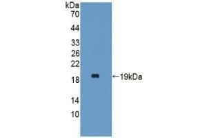 Detection of Recombinant HBa1, Mouse using Polyclonal Antibody to Hemoglobin Alpha 1 (HBa1) (HBA1 抗体  (AA 1-142))