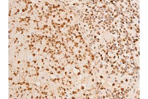 ABIN6267251 at 1/100 staining human TB tissue sections by IHC-P. (CHEK2 抗体  (pThr383))