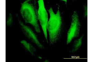 Immunofluorescence of monoclonal antibody to RHOA on HeLa cell. (RHOA 抗体  (AA 1-193))