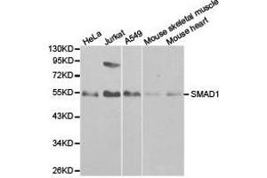 Western Blotting (WB) image for anti-SMAD, Mothers Against DPP Homolog 1 (SMAD1) antibody (ABIN1874850) (SMAD1 抗体)