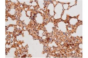 Immunohistochemistry (IHC) image for anti-Forkhead Box O4 (FOXO4) (pThr451) antibody (ABIN6256565)