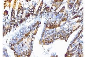 IHC analysis of EIF5A using anti-EIF5A antibody (ABIN7602568). (EIF5A 抗体  (AA 86-154))